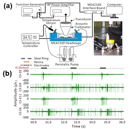 深圳先进院在超声神经调控领域研究获得新进展