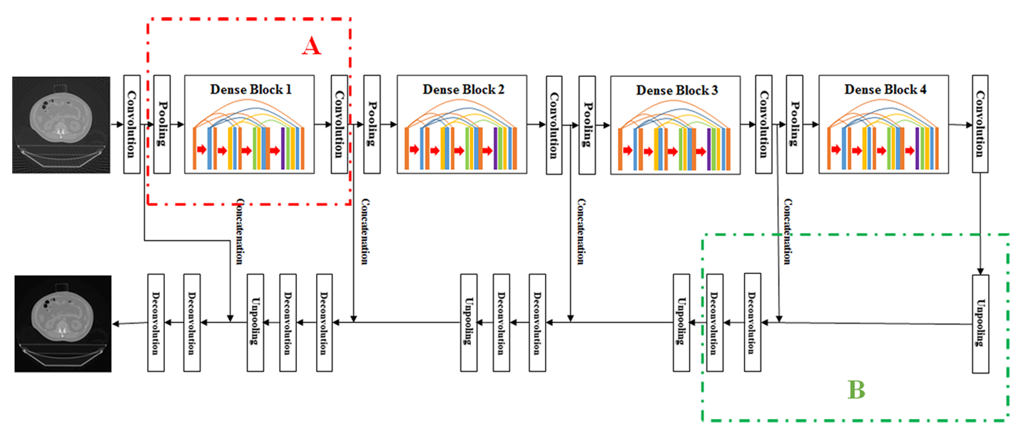 深圳先进院基于深度学习的CT投影数据重建获重要进展