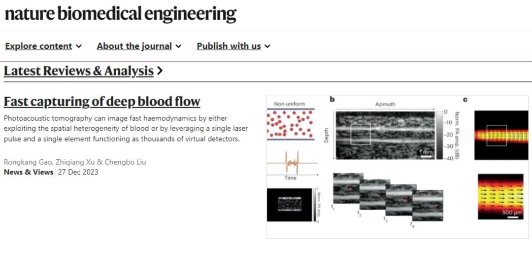 Nature BME | News & Views∣深层血流快速光声成像