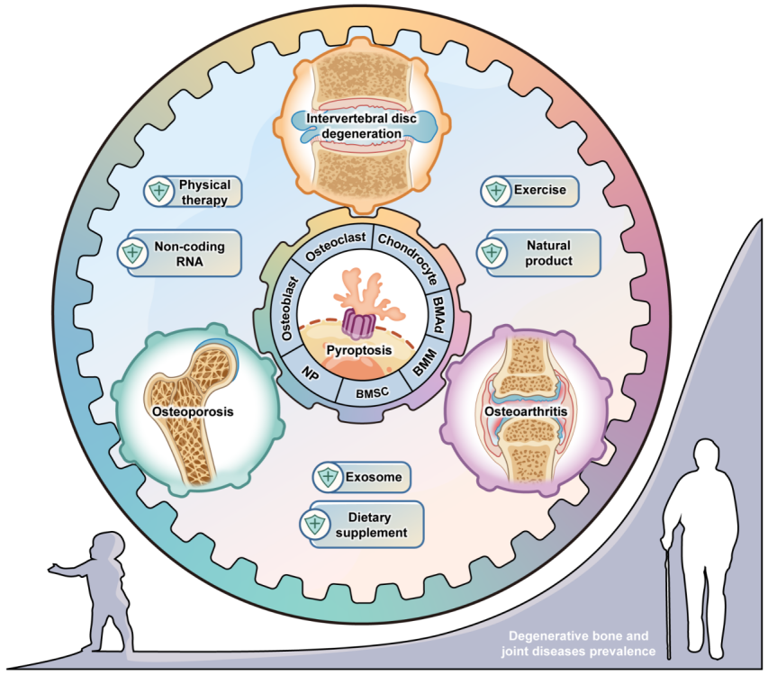 Journal of Advanced Research | 焦亡扰乱退行骨关节环境中细胞之间的和平相处
