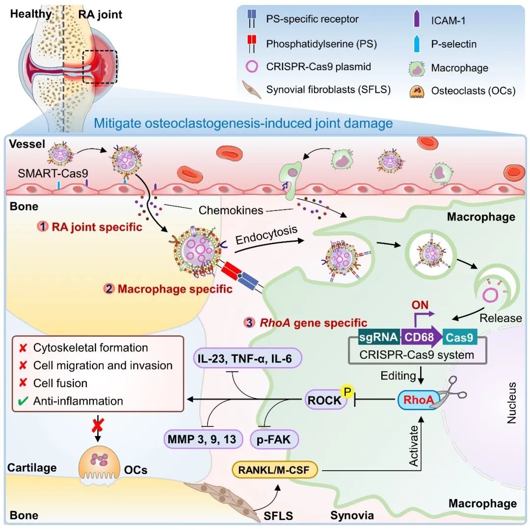 Cell Reports Medicine | 精准狙击类风湿关节炎促炎-破骨“元凶”